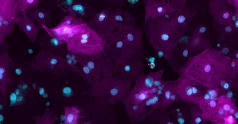 Common Issues With Aav Therapy Doses Needed And How To Address Them