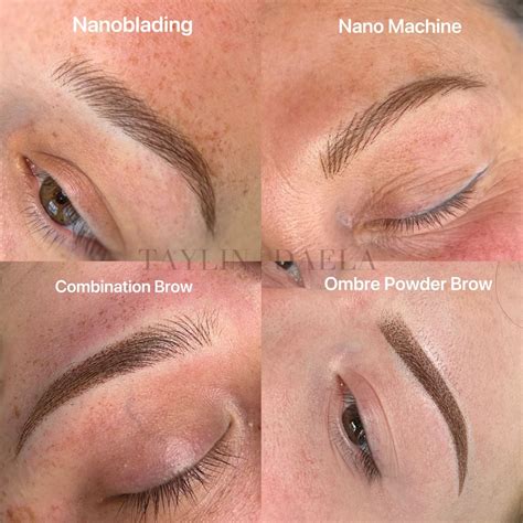 Blog Eyebrow Tattoos Emergency Brow Tattoo Removal Answering Your Blog Eyebrow Tattoos Emergency Brow Tattoo Removal Answering Your