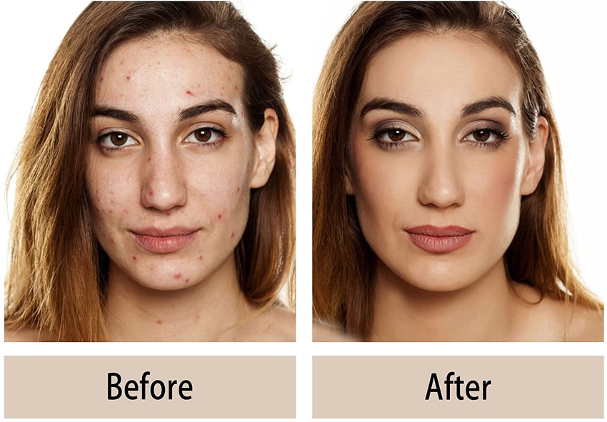 Scars Makeup On Face Saubhaya Makeup