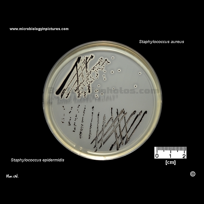 Staphylococcus Epidermidis Agar Staphylococcus Epidermidis Agar