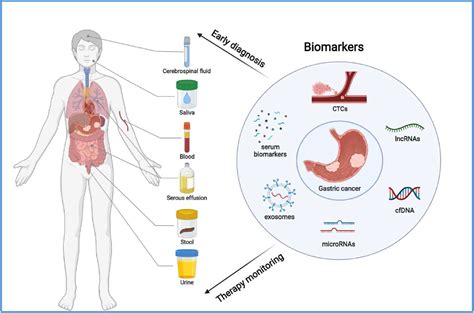 What Is A Biomarker Stomach Cancer Biomarkers